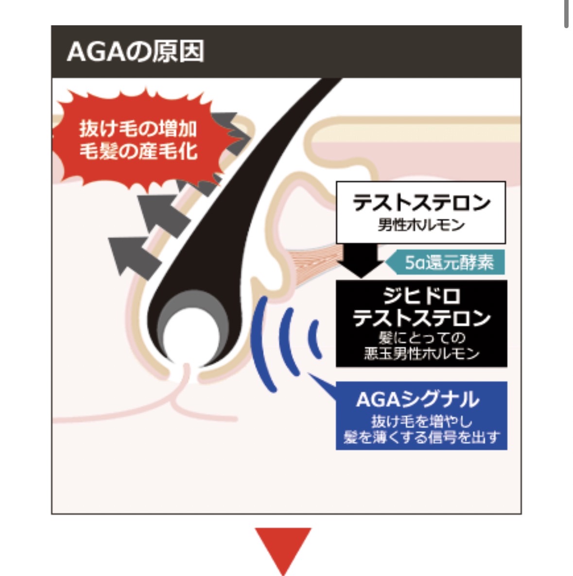 髪を生やす治療
